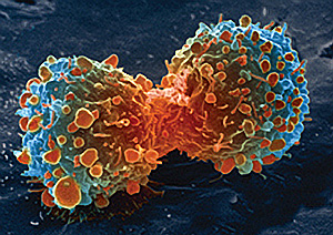 rak-pluca-brzo-raste-dijeljenjem-stanica